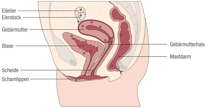 Endometriose kann an verschiedenen Stellen im Körper auftreten, zum Beispiel der Gebärmutter oder der Blase