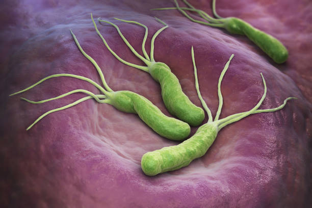 Helicobacter Pylori-Bakterien: Einer der Hauptrisikofaktoren für Magenkrebs